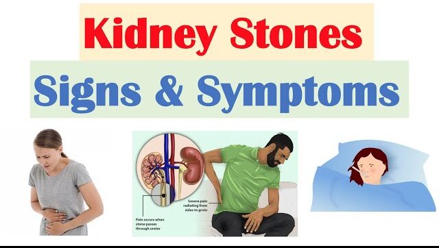 Understanding Kidney Stones: Types, Symptoms, and Treatment Options