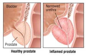 Urologist in Agra