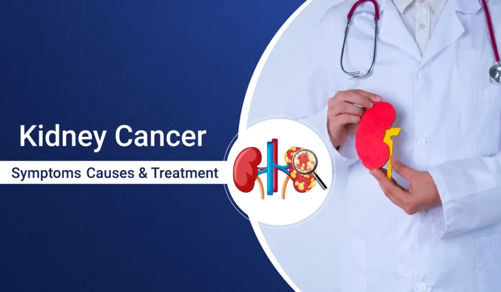 Understanding, Treating, and Caring for Kidney Cancer by Dr. Dilip Kumar Mishra, an Agra Urologist